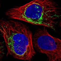 PLD5 Antibody, Novus Biologicals 25 &mu;L; Unlabeled:Antibodies, Polyclonal
